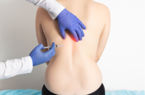 The doctor injects into the back of a girl to a patient to treat diseases of the spine and relax the muscles of the back.